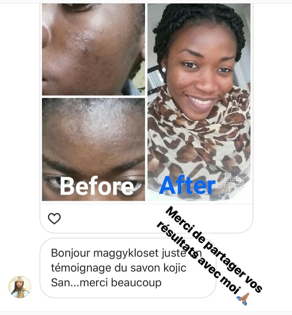 Savons Kojie San - Maggy Kloset